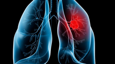 Cách dùng lá đu đủ chữa ung thư phổi mang lại hiệu quả bất ngờ